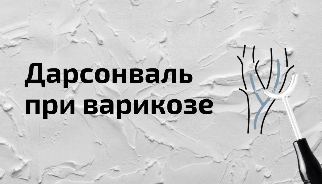 Лечение варикоза с помощью дарсонвализации. Эффект, методы проведения, противопоказания